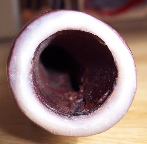 embouchure