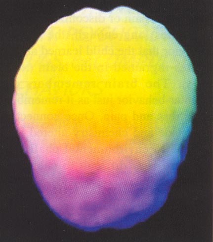 cerveau classique